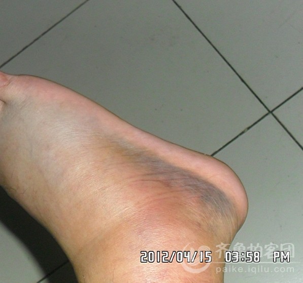 000357rc306dzviz70or76.jpg