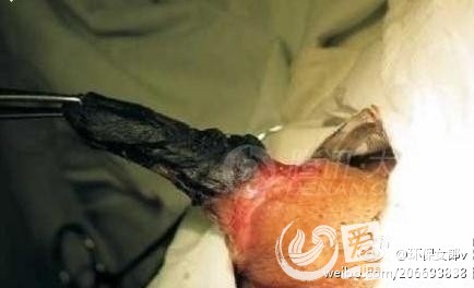 一男子和女友爱爱时jj突然自燃,烧焦了!照片惨不忍睹!