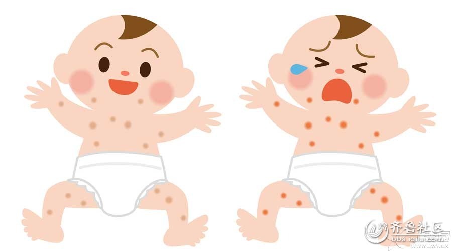 婴儿湿疹症状: 湿疹出现的主要症状是皮肤表面出现红斑、米粒样丘疹、疱疹、糜烂、渗液和结痂,炎症反应明显,局部皮肤有灼热感和痒感。 通常在宝宝的头、面颊、外耳部,甚至可以遍及整个颜面部和颈部,严重的手、足和胸腹部都可见到。 湿疹起初为鲜红色,略带水肿,边界清楚,表面湿润,继而转成主要症状。 婴儿湿疹的原因: 1、直接病因:引起宝宝湿疹病因是复杂的,其中过敏因素是最主要的,所以有过敏体质家族史(如父亲、母亲、祖父、祖母、外祖父、外祖母、兄弟姐妹等家庭成员有过湿疹、过敏性鼻炎、过敏性皮炎