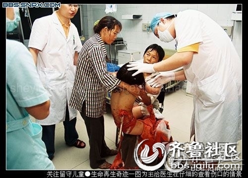 竹竿穿过9岁<em>小女孩胸部</em> 大难不死 - 齐鲁民声 -