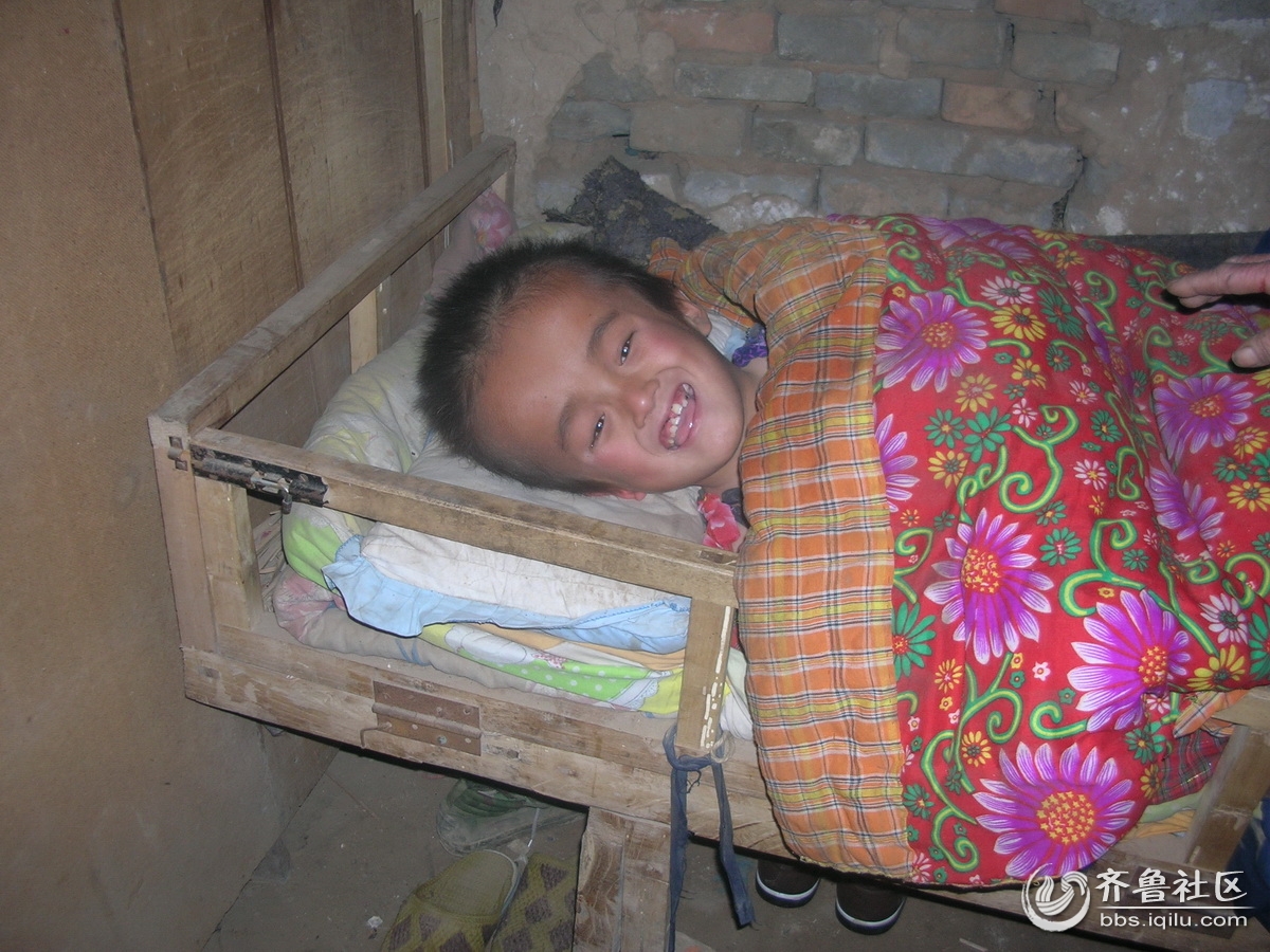 章丘黄河乡十岁男孩头大的出奇 社会各界关注