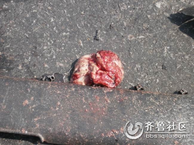 重大交通事故现场直击(有可能引起不适,慎入 慎